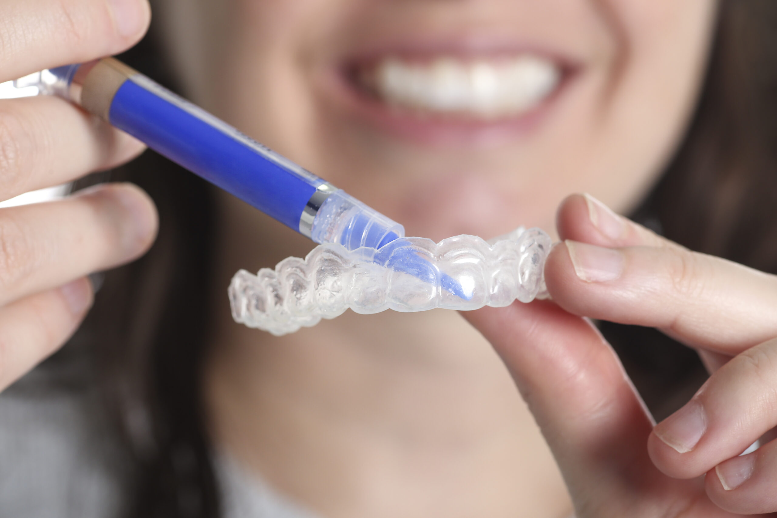 Teeth Whitening in Poole